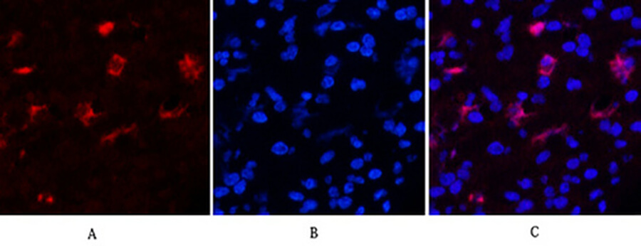 Fig.4. Immunofluorescence analysis of human appendix tissue. 1, Fibronectin Monoclonal Antibody  (red) was diluted at 1:200 (4°C, overnight). 2, Cy3 Labeled secondary antibody was diluted at 1:300 (room temperature, 50min). 3, Picture B: DAPI (blue) 10min. Picture A: Target. Picture B: DAPI. Picture C: merge of A+B.