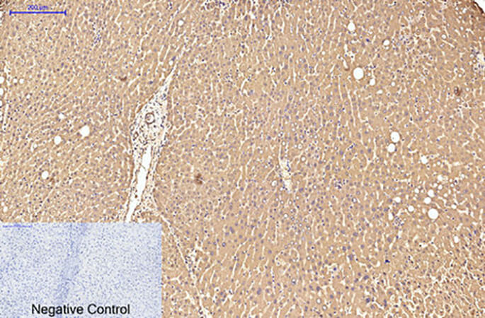 Fig.3. Immunohistochemical analysis of paraffin-embedded human liver tissue. 1, Transferrin Monoclonal Antibody was diluted at 1:200 (4°C, overnight). 2, Sodium citrate pH 6.0 was used for antibody retrieval (>98°C, 20min). 3, secondary antibody was diluted at 1:200 (room temperature, 30min). Negative control was used by secondary antibody only.
