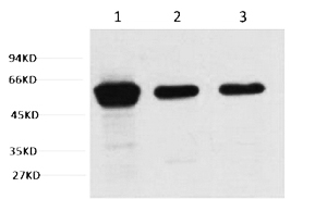 Fig.1. Western blot analysis of 1) Hela, 2) Mouse Brain Tissue, 3) Rat Brain tissue, diluted at 1:2000.