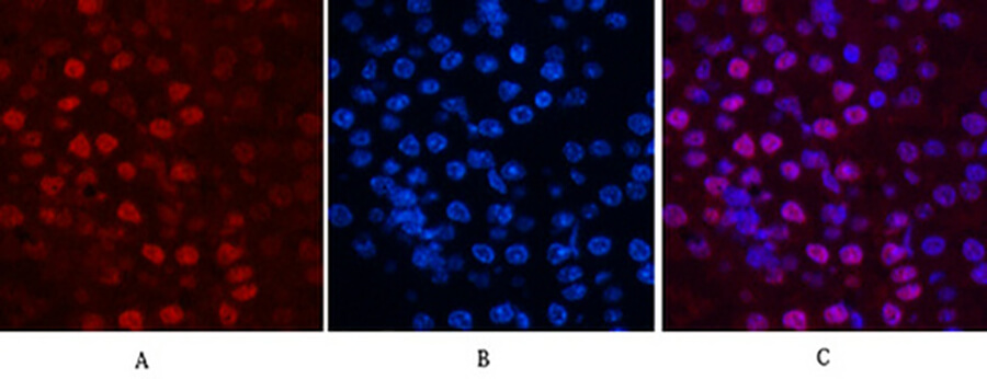 Fig.3. Immunofluorescence analysis of mouse kidney tissue. 1, Histone H2B Monoclonal Antibody (red) was diluted at 1:200 (4°C, overnight). 2, Cy3 Labeled secondary antibody was diluted at 1:300 (room temperature, 50min). 3, Picture B: DAPI (blue) 10min. Picture A: Target. Picture B: DAPI. Picture C: merge of A+B.