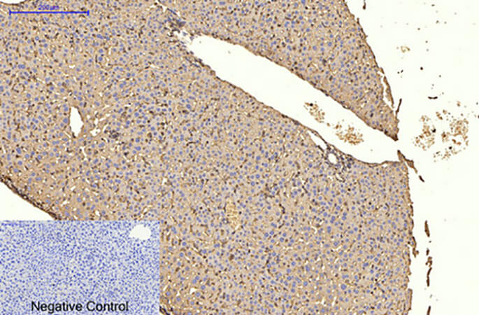 Fig.6. Immunohistochemical analysis of paraffin-embedded mouse liver tissue. 1, α-SMA Monoclonal Antibody  was diluted at 1:200 (4°C, overnight). 2, Sodium citrate pH 6.0 was used for antibody retrieval (>98°C, 20min). 3, secondary antibody was diluted at 1:200 (room temperature, 30min). Negative control was used by secondary antibody only.