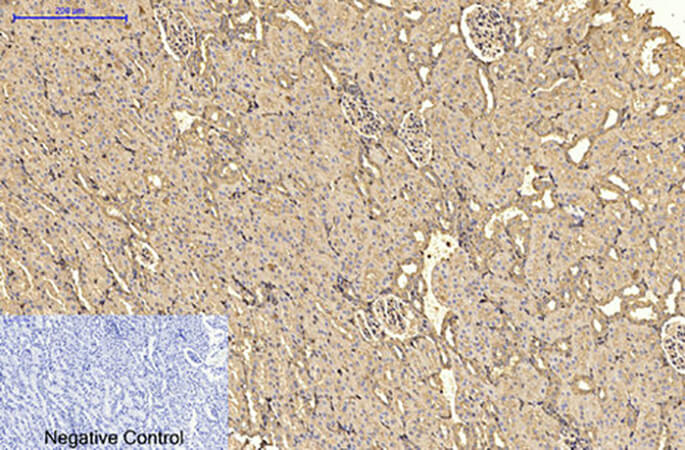 Fig.7. Immunohistochemical analysis of paraffin-embedded rat kidney tissue. 1, α-SMA Monoclonal Antibody  was diluted at 1:200 (4°C, overnight). 2, Sodium citrate pH 6.0 was used for antibody retrieval (>98°C, 20min). 3, secondary antibody was diluted at 1:200 (room temperature, 30min). Negative control was used by secondary antibody only.