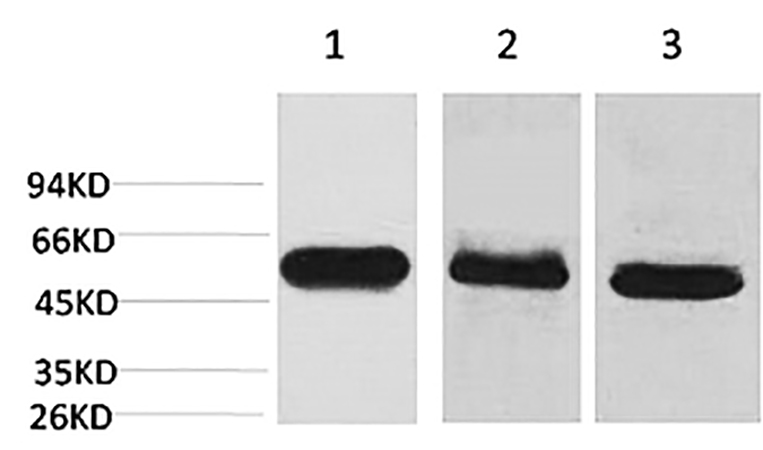 Fig.1. Western blot analysis of 1) Hela, 2) mouse brain tissue, 3) rat brain tissue using Caspase-8 Monoclonal Antibody.