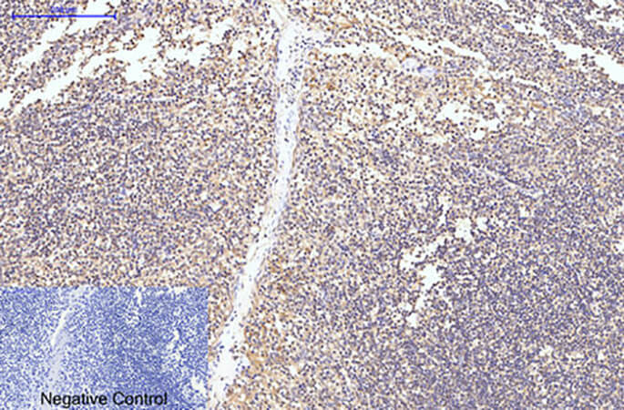 Fig.2. Immunohistochemical analysis of paraffin-embedded human tonsil tissue. 1, Caspase-8 Monoclonal Antibody was diluted at 1:200 (4°C, overnight). 2, Sodium citrate pH 6.0 was used for antibody retrieval (>98°C, 20min). 3, secondary antibody was diluted at 1:200 (room temperature, 30min). Negative control was used by secondary antibody only.
