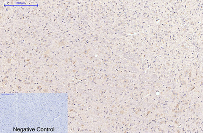 Fig.3. Immunohistochemical analysis of paraffin-embedded mouse brain tissue. 1, Caspase-8 Monoclonal Antibody was diluted at 1:200 (4°C, overnight). 2, Sodium citrate pH 6.0 was used for antibody retrieval (>98°C, 20min). 3, secondary antibody was diluted at 1:200 (room temperature, 30min). Negative control was used by secondary antibody only.