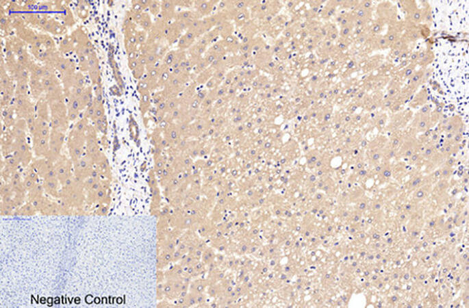 Fig.2. Immunohistochemical analysis of paraffin-embedded human liver tissue. 1, Catenin-β Monoclonal Antibody  was diluted at 1:200 (4°C, overnight). 2, Sodium citrate pH 6.0 was used for antibody retrieval (>98°C, 20min). 3, secondary antibody was diluted at 1:200 (room temperature, 30min). Negative control was used by secondary antibody only.