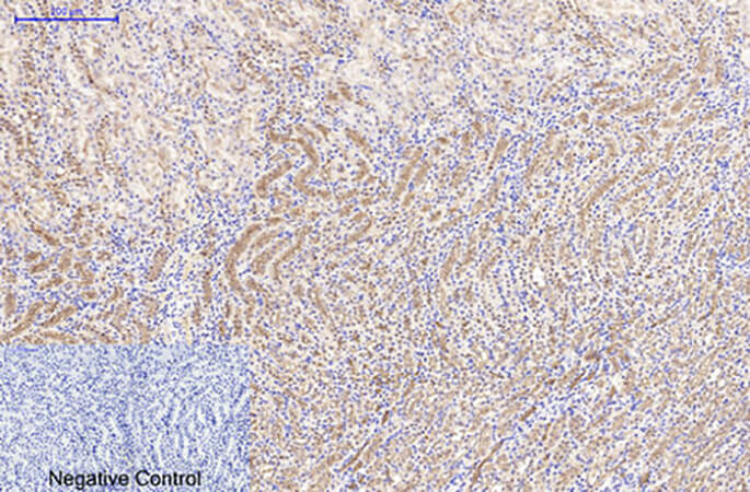 Fig.3. Immunohistochemical analysis of paraffin-embedded mouse kidney tissue. 1, Catenin-β Monoclonal Antibody  was diluted at 1:200 (4°C, overnight). 2, Sodium citrate pH 6.0 was used for antibody retrieval (>98°C, 20min). 3, secondary antibody was diluted at 1:200 (room temperature, 30min). Negative control was used by secondary antibody only.