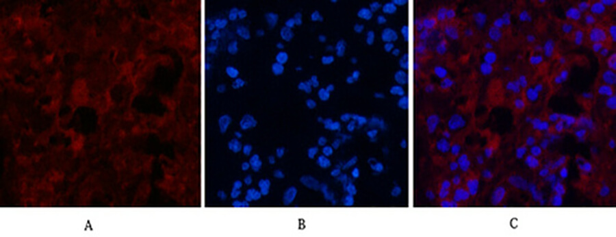 Fig.2. Immunofluorescence analysis of human appendix tissue. 1, MICU1 Monoclonal Antibody (red) was diluted at 1:200 (4°C, overnight). 2, Cy3 Labeled secondary antibody was diluted at 1:300 (room temperature, 50min). 3, Picture B: DAPI (blue) 10min. Picture A: Target. Picture B: DAPI. Picture C: merge of A+B.
