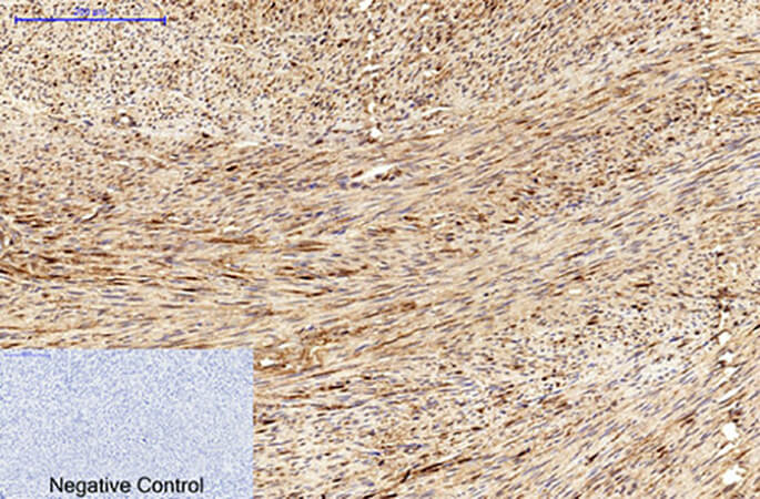Fig.3. Immunohistochemical analysis of paraffin-embedded human uterus tissue. 1, MICU1 Monoclonal Antibody was diluted at 1:200 (4°C, overnight). 2, Sodium citrate pH 6.0 was used for antibody retrieval (>98°C, 20min). 3, secondary antibody was diluted at 1:200 (room temperature, 30min). Negative control was used by secondary antibody only.