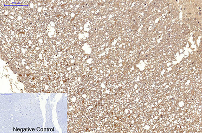 Fig.5. Immunohistochemical analysis of paraffin-embedded rat spinal cord tissue. 1, MICU1 Monoclonal Antibody was diluted at 1:200 (4°C, overnight). 2, Sodium citrate pH 6.0 was used for antibody retrieval (>98°C, 20min). 3, secondary antibody was diluted at 1:200 (room temperature, 30min). Negative control was used by secondary antibody only.