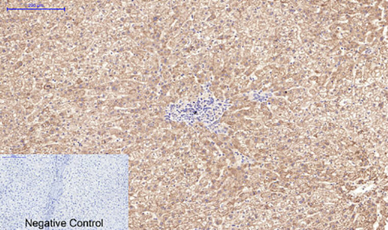 Fig.3. Immunohistochemical analysis of paraffin-embedded human liver tissue. 1, Active Caspase-3 Monoclonal Antibody  was diluted at 1:200 (4°C, overnight). 2, Sodium citrate pH 6.0 was used for antibody retrieval (>98°C, 20min). 3, secondary antibody was diluted at 1:200 (room temperature, 30min). Negative control was used by secondary antibody only.