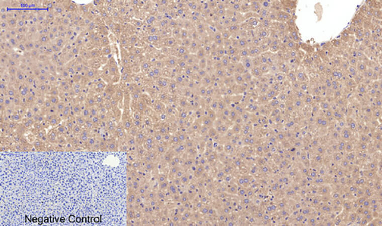 Fig.4. Immunohistochemical analysis of paraffin-embedded mouse liver tissue. 1, Active Caspase-3 Monoclonal Antibody  was diluted at 1:200 (4°C, overnight). 2, Sodium citrate pH 6.0 was used for antibody retrieval (>98°C, 20min). 3, secondary antibody was diluted at 1:200 (room temperature, 30min). Negative control was used by secondary antibody only.