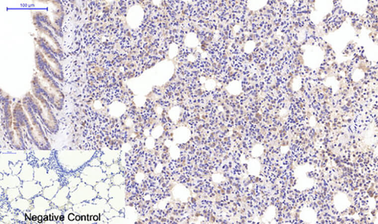Fig.5. Immunohistochemical analysis of paraffin-embedded rat lung tissue. 1, Active Caspase-3 Monoclonal Antibody  was diluted at 1:200 (4°C, overnight). 2, Sodium citrate pH 6.0 was used for antibody retrieval (>98°C, 20min). 3, secondary antibody was diluted at 1:200 (room temperature, 30min). Negative control was used by secondary antibody only.