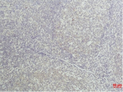 Fig.2. Immunohistochemical analysis of paraffin-embedded Human Tonsil Tissue using TNF aMouse mAb diluted at 1:50.