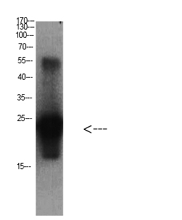 Fig. Western Blot analysis of Cystatin C protein using antibody diluted at 1:1000.