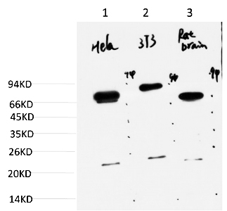 Fig.2. Western blot analysis of 1) Hela Cell Lysate, 2) 3T3 Cell Lysate, 3) Rat Brain Tissue Lysate using Ubiquitin Mouse mAb diluted at 1:1000.