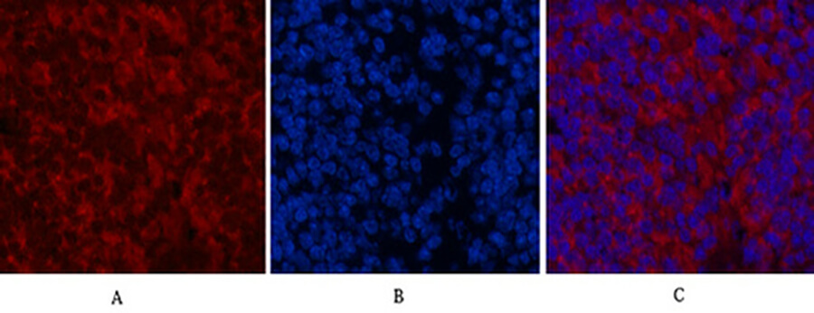 Fig.2. Immunofluorescence analysis of mouse spleen tissue. 1, LC3A Mouse Monoclonal Antibody (5G10) (red) was diluted at 1:200 (4°C, overnight). 2, Cy3 Labeled secondary antibody was diluted at 1:300 (room temperature, 50min). 3, Picture B: DAPI (blue) 10min. Picture A: Target. Picture B: DAPI. Picture C: merge of A+B.