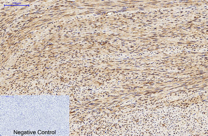 Fig.3. Immunohistochemical analysis of paraffin-embedded human uterus tissue. 1, LC3A Mouse Monoclonal Antibody (5G10) was diluted at 1:200 (4°C, overnight). 2, Sodium citrate pH 6.0 was used for antibody retrieval (>98°C, 20min). 3, secondary antibody was diluted at 1:200 (room temperature, 30min). Negative control was used by secondary antibody only.