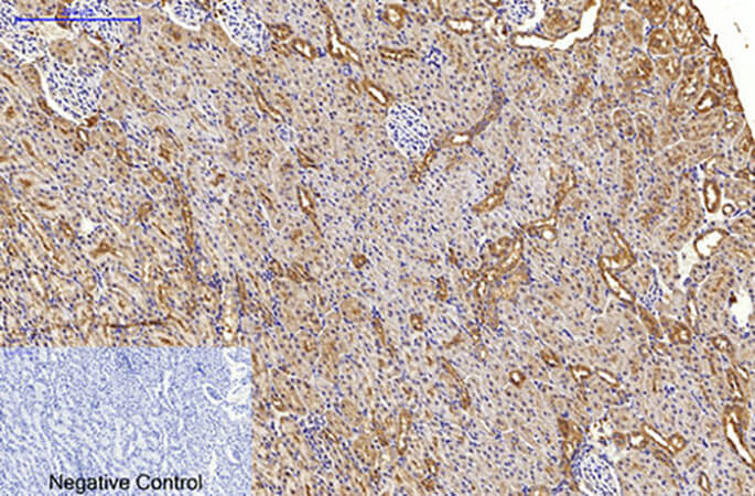 Fig.4. Immunohistochemical analysis of paraffin-embedded rat kidney tissue. 1, LC3A Mouse Monoclonal Antibody (5G10) was diluted at 1:200 (4°C, overnight). 2, Sodium citrate pH 6.0 was used for antibody retrieval (>98°C, 20min). 3, secondary antibody was diluted at 1:200 (room temperature, 30min). Negative control was used by secondary antibody only.