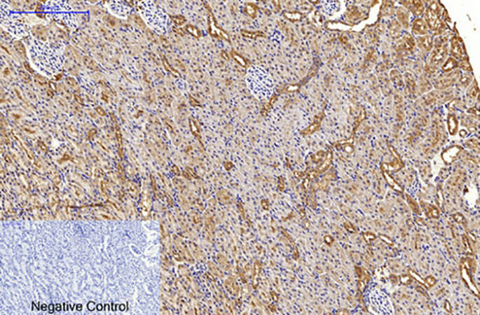 Fig.4. Immunohistochemical analysis of paraffin-embedded rat kidney tissue. 1, LC3A Mouse Monoclonal Antibody (5G10) was diluted at 1:200 (4°C, overnight). 2, Sodium citrate pH 6.0 was used for antibody retrieval (>98°C, 20min). 3, secondary antibody was diluted at 1:200 (room temperature, 30min). Negative control was used by secondary antibody only.