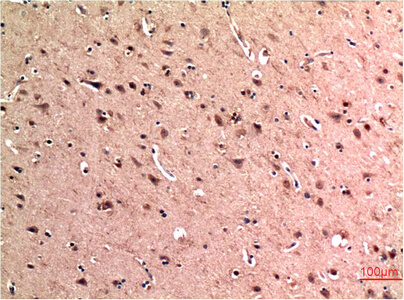 Fig.1. Immunohistochemical analysis of paraffin-embedded Human Brain Tissue using Beclin-1 Mouse mAb diluted at 1:200.