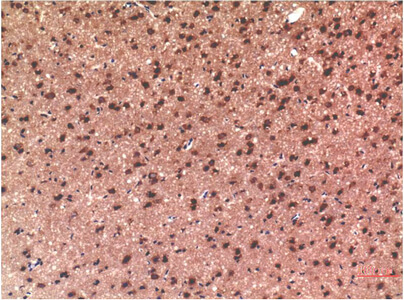 Fig.1. Immunohistochemical analysis of paraffin-embedded Rat Brain Tissue using Tau Mouse mAb diluted at 1:200.