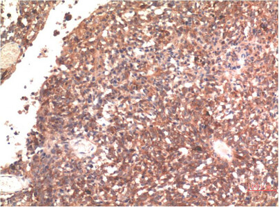 Fig.2. Immunohistochemical analysis of paraffin-embedded Human Brain Tissue using Tau Mouse mAb diluted at 1:200.