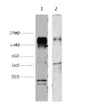 Fig.1. Western blot analysis of 1) Hela, 2) mouse brain, diluted at 1:4000.