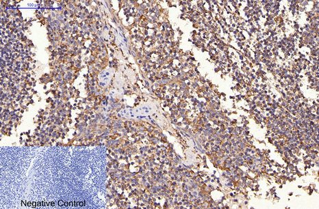 Fig.2. Immunohistochemical analysis of paraffin-embedded human tonsil tissue. 1, HER2 Monoclonal Antibody was diluted at 1:200 (4°C, overnight). 2, Sodium citrate pH 6.0 was used for antibody retrieval (>98°C, 20min). 3, secondary antibody was diluted at 1:200 (room temperature, 30min). Negative control was used by secondary antibody only.