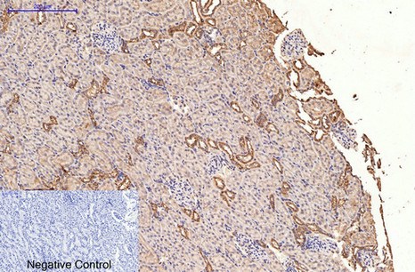 Fig.4. Immunohistochemical analysis of paraffin-embedded rat kidney tissue. 1, HER2 Monoclonal Antibody was diluted at 1:200 (4°C, overnight). 2, Sodium citrate pH 6.0 was used for antibody retrieval (>98°C, 20min). 3, secondary antibody was diluted at 1:200 (room temperature, 30min). Negative control was used by secondary antibody only.