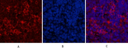 Fig.6. Immunofluorescence analysis of rat spleen tissue. 1, HER2 Monoclonal Antibody (red) was diluted at 1:200 (4°C, overnight). 2, Cy3 Labeled secondary antibody was diluted at 1:300 (room temperature, 50min). 3, Picture B: DAPI (blue) 10min. Picture A: Target. Picture B: DAPI. Picture C: merge of A+B.