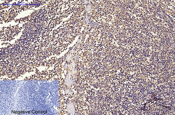 Fig.1. Immunohistochemical analysis of paraffin-embedded human tonsil tissue. 1, CD68 Monoclonal Antibody was diluted at 1:200 (4°C, overnight). 2, Sodium citrate pH 6.0 was used for antibody retrieval (>98°C, 20min). 3, secondary antibody was diluted at 1:200 (room temperature, 30min). Negative control was used by secondary antibody only.