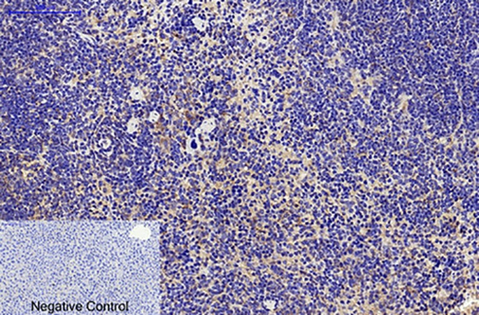 Fig.2. Immunohistochemical analysis of paraffin-embedded mouse liver tissue. 1, CD68 Monoclonal Antibody  was diluted at 1:200 (4°C, overnight). 2, Sodium citrate pH 6.0 was used for antibody retrieval (>98°C, 20min). 3, secondary antibody was diluted at 1:200 (room temperature, 30min). Negative control was used by secondary antibody only.