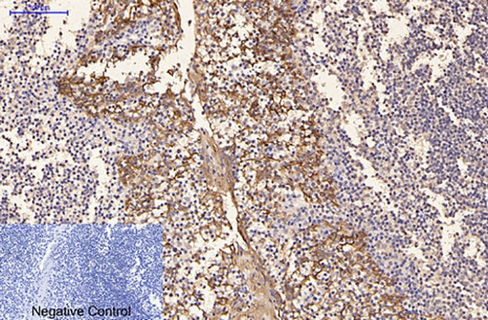 Fig.1. Immunohistochemical analysis of paraffin-embedded human tonsil tissue. 1, CK16 Monoclonal Antibody was diluted at 1:200 (4°C, overnight). 2, Sodium citrate pH 6.0 was used for antibody retrieval (>98°C, 20min). 3, secondary antibody was diluted at 1:200 (room temperature, 30min). Negative control was used by secondary antibody only.