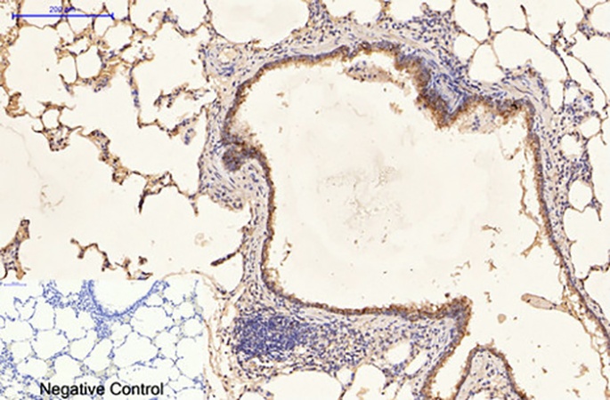 Fig.2. Immunohistochemical analysis of paraffin-embedded rat lung tissue. 1, CK16 Monoclonal Antibody was diluted at 1:200 (4°C, overnight). 2, Sodium citrate pH 6.0 was used for antibody retrieval (>98°C, 20min). 3, secondary antibody was diluted at 1:200 (room temperature, 30min). Negative control was used by secondary antibody only.