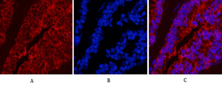 Fig.4. Immunofluorescence analysis of mouse lung tissue. 1, CK16 Monoclonal Antibody (red) was diluted at 1:200 (4°C, overnight). 2, Cy3 Labeled secondary antibody was diluted at 1:300 (room temperature, 50min). 3, Picture B: DAPI (blue) 10min. Picture A: Target. Picture B: DAPI. Picture C: merge of A+B.