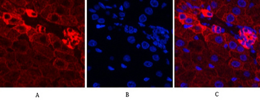 Fig.5. Immunofluorescence analysis of rat liver tissue. 1, CK16 Monoclonal Antibody (red) was diluted at 1:200 (4°C, overnight). 2, Cy3 Labeled secondary antibody was diluted at 1:300 (room temperature, 50min). 3, Picture B: DAPI (blue) 10min. Picture A: Target. Picture B: DAPI. Picture C: merge of A+B.