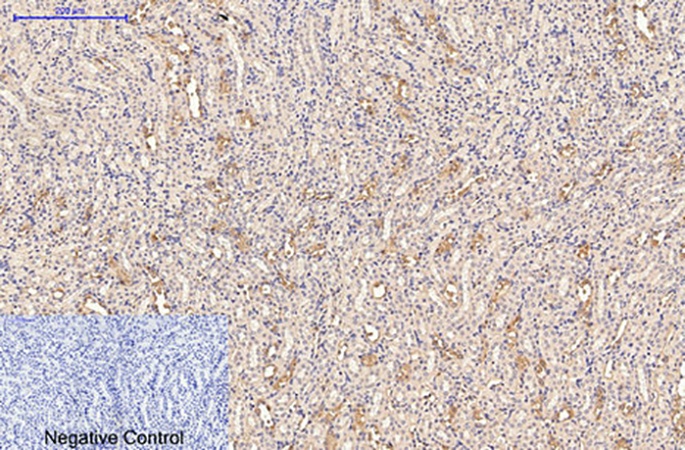 Fig.2. Immunohistochemical analysis of paraffin-embedded mouse kidney tissue. 1, CD21 Monoclonal Antibody was diluted at 1:200 (4°C, overnight). 2, Sodium citrate pH 6.0 was used for antibody retrieval (>98°C, 20min). 3, secondary antibody was diluted at 1:200 (room temperature, 30min). Negative control was used by secondary antibody only.
