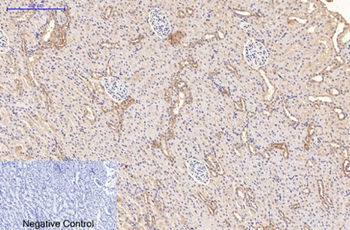 Fig.3. Immunohistochemical analysis of paraffin-embedded rat kidney tissue. 1, CD21 Monoclonal Antibody was diluted at 1:200 (4°C, overnight). 2, Sodium citrate pH 6.0 was used for antibody retrieval (>98°C, 20min). 3, secondary antibody was diluted at 1:200 (room temperature, 30min). Negative control was used by secondary antibody only.