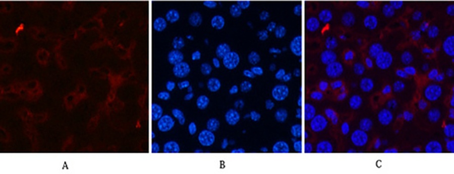 Fig.4. Immunofluorescence analysis of mouse liver tissue. 1, CD21 Monoclonal Antibody (red) was diluted at 1:200 (4°C, overnight). 2, Cy3 Labeled secondary antibody was diluted at 1:300 (room temperature, 50min). 3, Picture B: DAPI (blue) 10min. Picture A: Target. Picture B: DAPI. Picture C: merge of A+B.