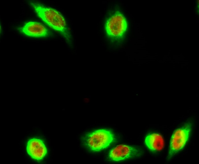 Fig.1. Immunofluorescence analysis of Hela cell. Primary antibody: Annexin VI Polyclonal Antibody (green) was diluted at 1:200 (4° overnight). Ki 67 Monoclonal Antibody (red) was diluted at 1:200 (4° overnight). Secondary antibody: Goat Anti Rabbit DyLight 488 (A23220) was diluted at 1:1000 (room temperature, 50min). Goat Anti Mouse DyLight 594 (A23410) was diluted at 1:1000 (room temperature, 50min).
