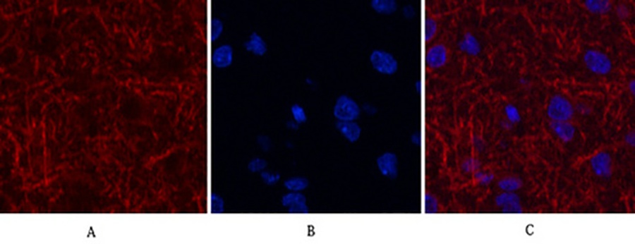 Fig.2. Immunofluorescence analysis of rat brain tissue. 1, MAP2 Monoclonal Antibody (red) was diluted at 1:200 (4°C, overnight). 2, Cy3 Labeled secondary antibody was diluted at 1:300 (room temperature, 50min). 3, Picture B: DAPI (blue) 10min. Picture A: Target. Picture B: DAPI. Picture C: merge of A+B.