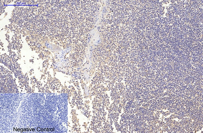 Fig.3. Immunohistochemical analysis of paraffin-embedded human tonsil tissue. 1, MAP2 Monoclonal Antibody  was diluted at 1:200 (4°C, overnight). 2, Sodium citrate pH 6.0 was used for antibody retrieval (>98°C, 20min). 3, secondary antibody was diluted at 1:200 (room temperature, 30min). Negative control was used by secondary antibody only.