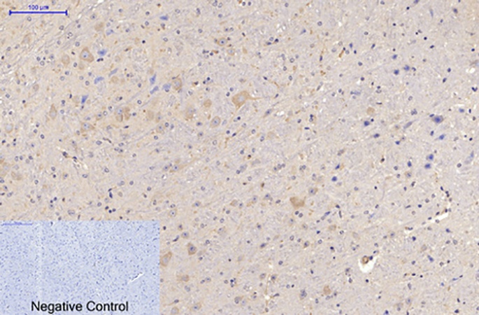 Fig.4. Immunohistochemical analysis of paraffin-embedded mouse brain tissue. 1, MAP2 Monoclonal Antibody was diluted at 1:200 (4°C, overnight). 2, Sodium citrate pH 6.0 was used for antibody retrieval (>98°C, 20min). 3, secondary antibody was diluted at 1:200 (room temperature, 30min). Negative control was used by secondary antibody only.