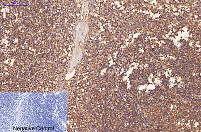 Fig.1. Immunohistochemical analysis of paraffin-embedded human tonsil tissue. 1, CD1 Monoclonal Antibody was diluted at 1:200 (4°C, overnight). 2, Sodium citrate pH 6.0 was used for antibody retrieval (>98°C, 20min). 3, secondary antibody was diluted at 1:200 (room temperature, 30min). Negative control was used by secondary antibody only.