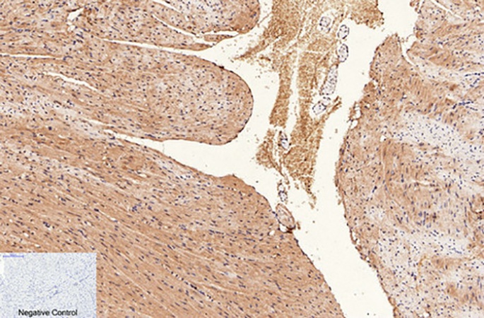 Fig.2. Immunohistochemical analysis of paraffin-embedded mouse heart tissue. 1, CD1 Monoclonal Antibody was diluted at 1:200 (4°C, overnight). 2, Sodium citrate pH 6.0 was used for antibody retrieval (>98°C, 20min). 3, secondary antibody was diluted at 1:200 (room temperature, 30min). Negative control was used by secondary antibody only.