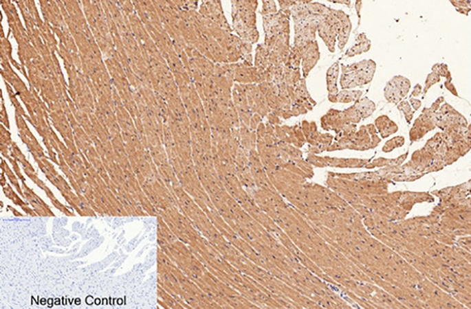 Fig.3. Immunohistochemical analysis of paraffin-embedded rat heart tissue. 1, CD1 Monoclonal Antibody was diluted at 1:200 (4°C, overnight). 2, Sodium citrate pH 6.0 was used for antibody retrieval (>98°C, 20min). 3, secondary antibody was diluted at 1:200 (room temperature, 30min). Negative control was used by secondary antibody only.