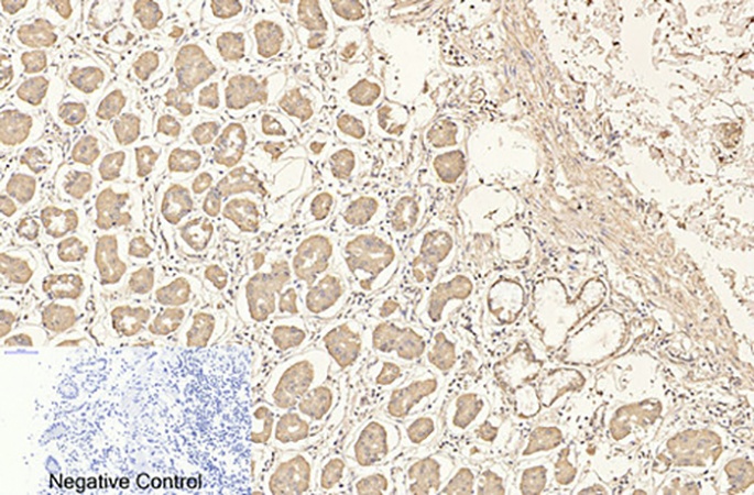 Fig.1. Immunohistochemical analysis of paraffin-embedded human stomach tissue. 1, CD4 Monoclonal Antibody was diluted at 1:200 (4°C, overnight). 2, Sodium citrate pH 6.0 was used for antibody retrieval (>98°C, 20min). 3, secondary antibody was diluted at 1:200 (room temperature, 30min). Negative control was used by secondary antibody only.