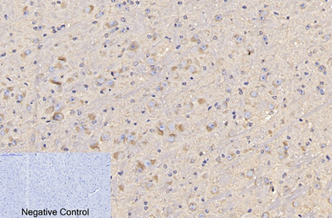 Fig.2. Immunohistochemical analysis of paraffin-embedded mouse brain tissue. 1, CD4 Monoclonal Antibody was diluted at 1:200 (4°C, overnight). 2, Sodium citrate pH 6.0 was used for antibody retrieval (>98°C, 20min). 3, secondary antibody was diluted at 1:200 (room temperature, 30min). Negative control was used by secondary antibody only.