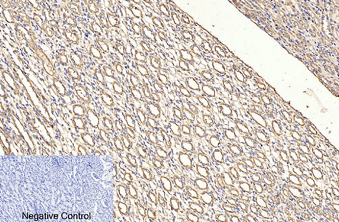 Fig.3. Immunohistochemical analysis of paraffin-embedded rat kidney tissue. 1, CD4 Monoclonal Antibody was diluted at 1:200 (4°C, overnight). 2, Sodium citrate pH 6.0 was used for antibody retrieval (>98°C, 20min). 3, secondary antibody was diluted at 1:200 (room temperature, 30min). Negative control was used by secondary antibody only.